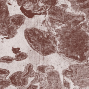 L'Unistra dans les médias