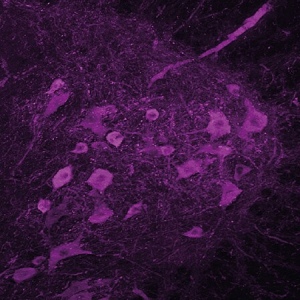 Maladie de Charcot : les troubles du sommeil précèdent l’apparition des premiers symptômes moteurs