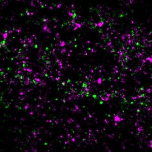 VIH : une étape du cycle viral décryptée